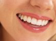 Cosmetica dentara