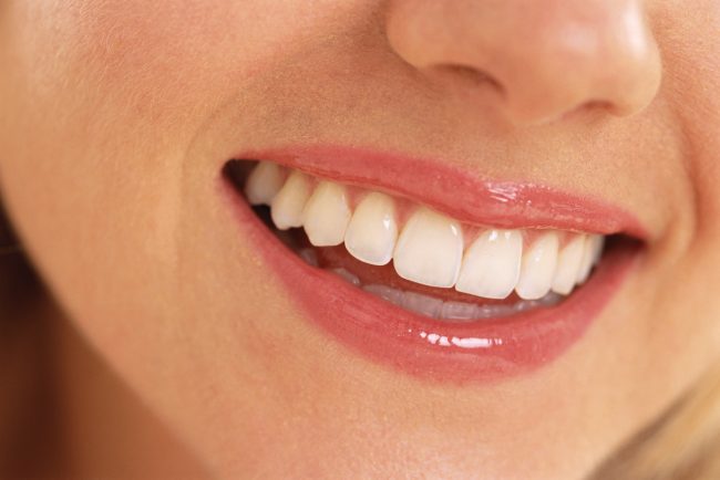 Cosmetica dentara